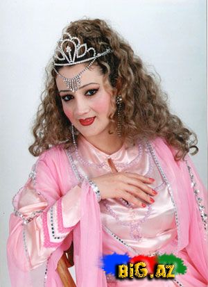 Şou-biznesimizin plastik əməliyyat keçirən simaları